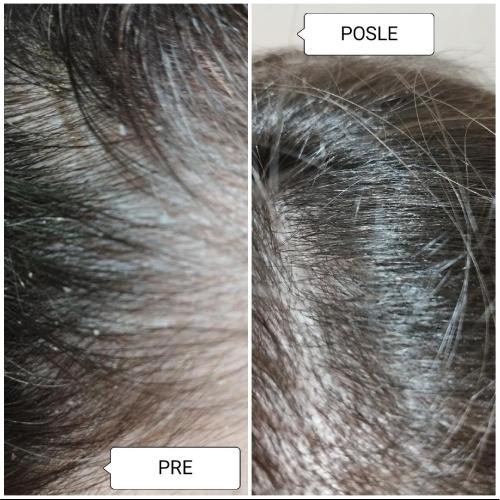 image(55) â kopija