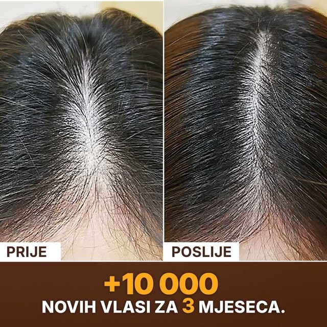 image(5)