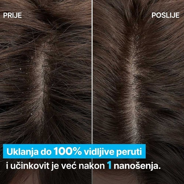 image(5) â kopija